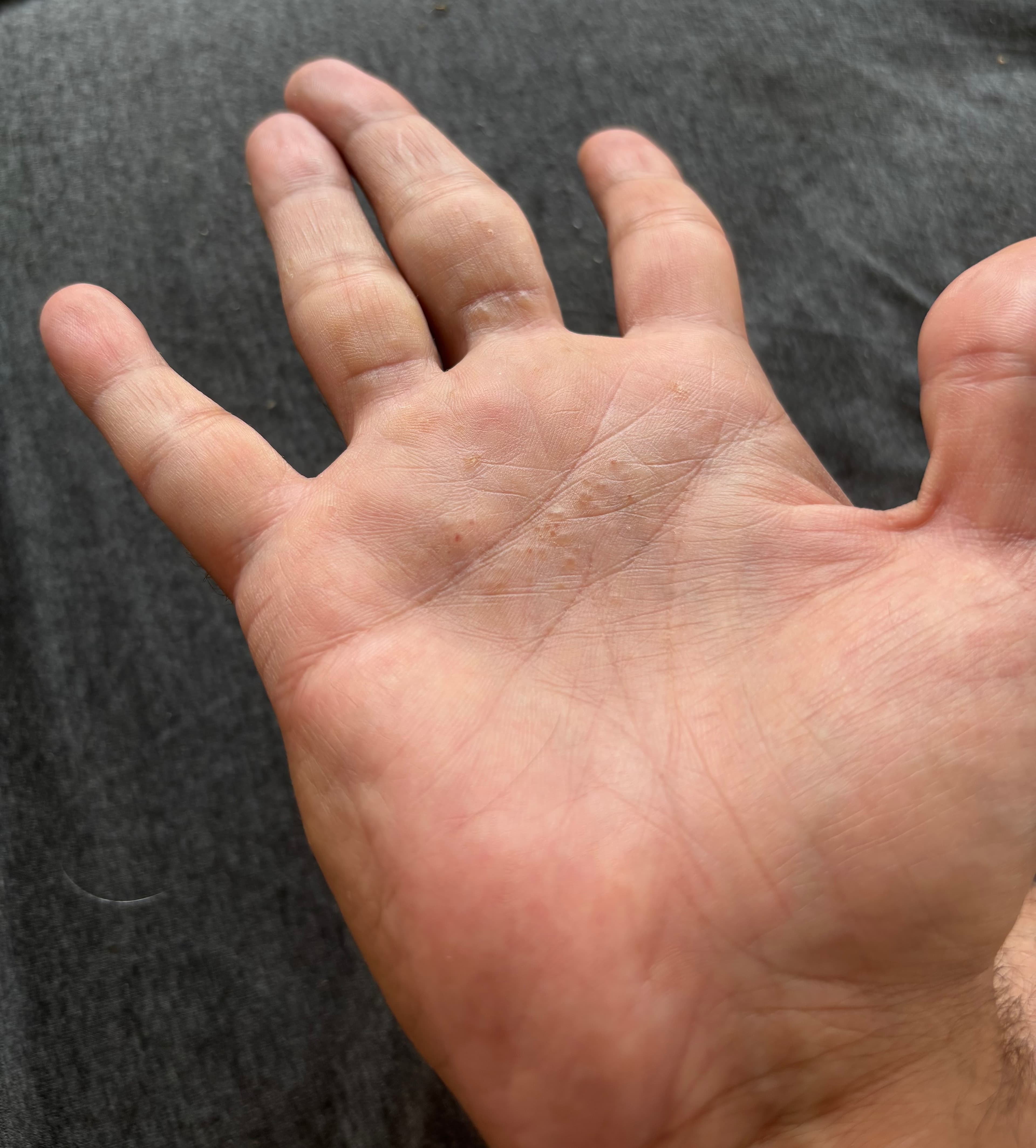 Problems seen in my hand